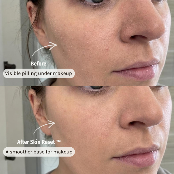 Skin Reset™ Barrier Restore Cream